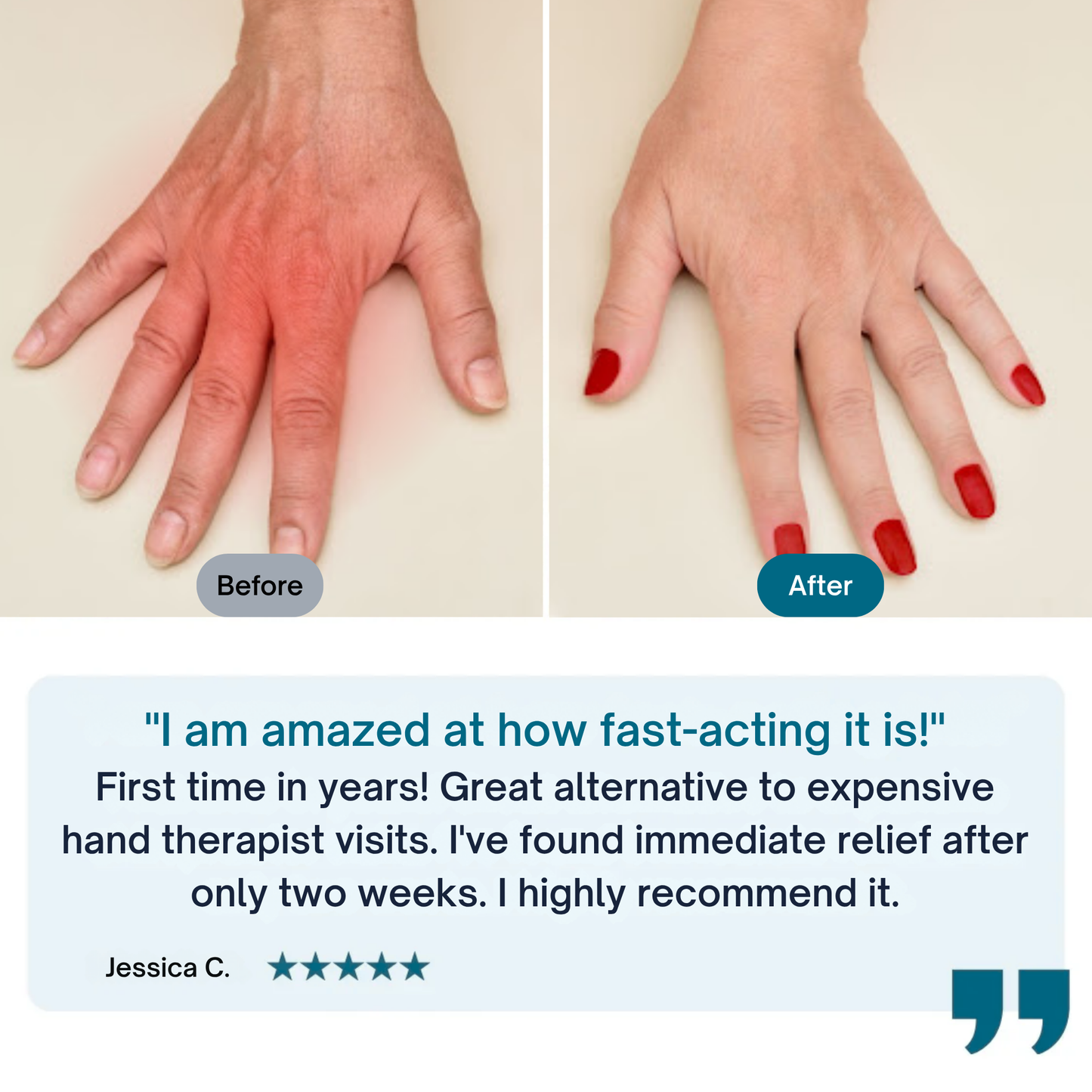 Nuvexaris™ 3-in-1 Hand Massager: A Comprehensive At-Home Hand Care Solution